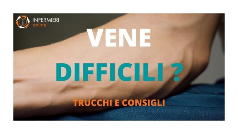 Le Cause delle Vene Difficili da Trovare