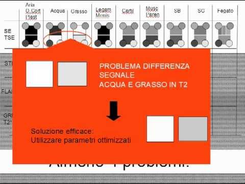 Alterazioni del Segnale nella Risonanza Magnetica: Una Guida Completa