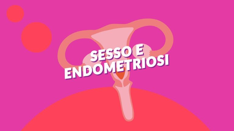 Le migliori posizioni sessuali per l'endometriosi